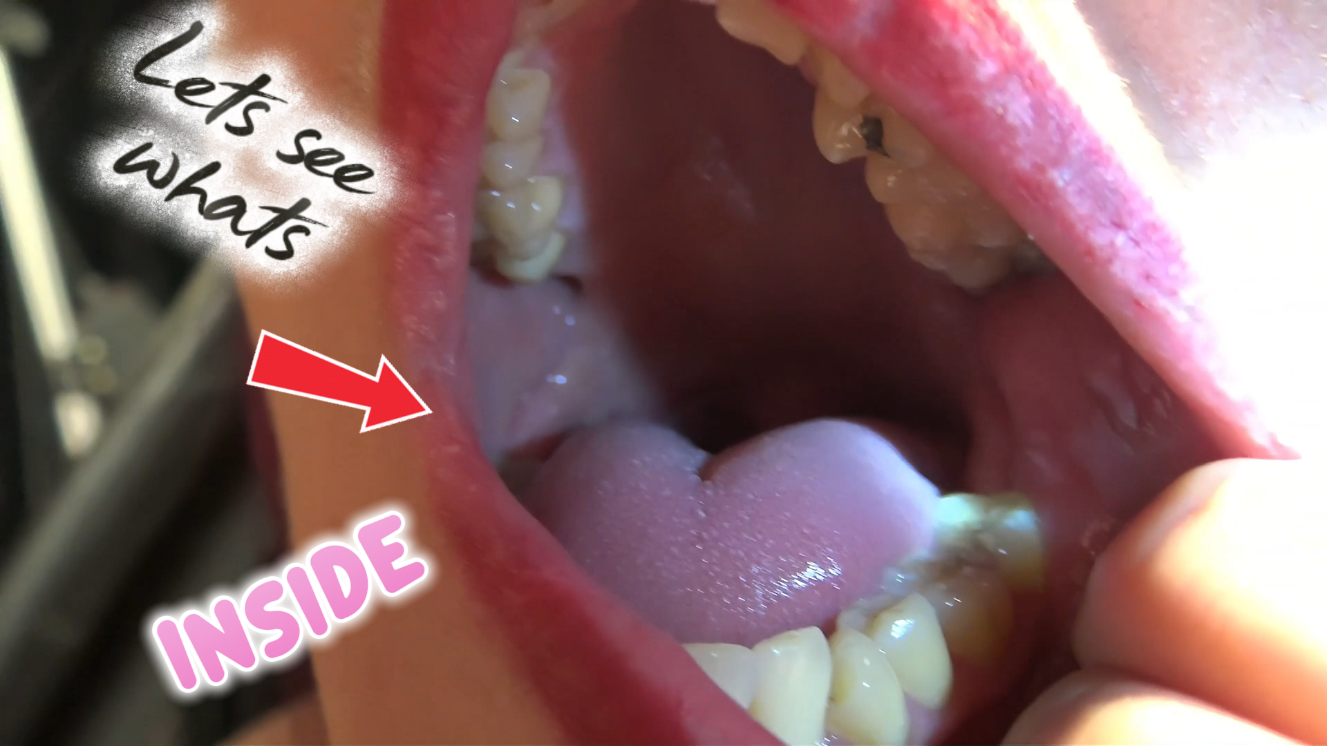 mouth clip 221 thumbnail